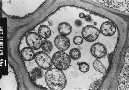 Биологи выяснили, как фитоплазма превращает растения в зомби
