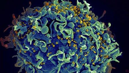 Обнаружен белок, препятствующий размножению ВИЧ